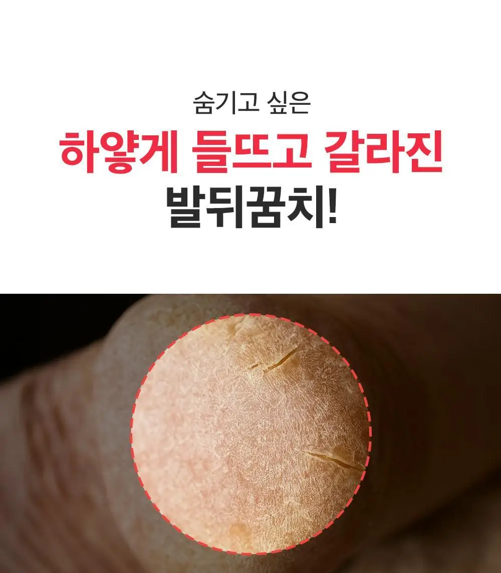 [데일리풋케어/맨들맨들아기발] 성분에디터 시어버터 베이비 풋 스틱 20g 2종 택 1 상세페이지 17